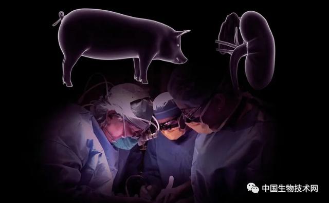 世界首例猪肾脏移植人体手术成功