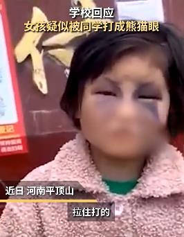 警方辟谣女孩被同学打成“熊猫眼”：偷妈妈钱被打，女孩妈妈正接受调查 