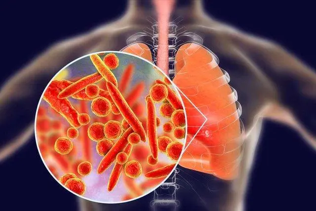 肺炎支原体感染迎来高峰?医生回应