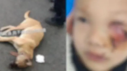 8岁男童遭狗扑咬 脸上缝了90多针