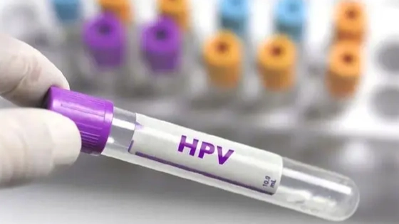 男童喉咙长菜花样肿块确诊感染HPV