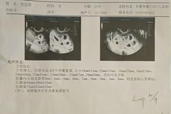 怀9胞胎女子丈夫希望留两胎