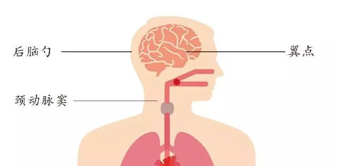 正式确诊衣领综合征