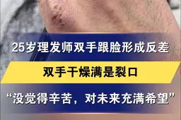 25岁理发师双手与脸形成巨大反差