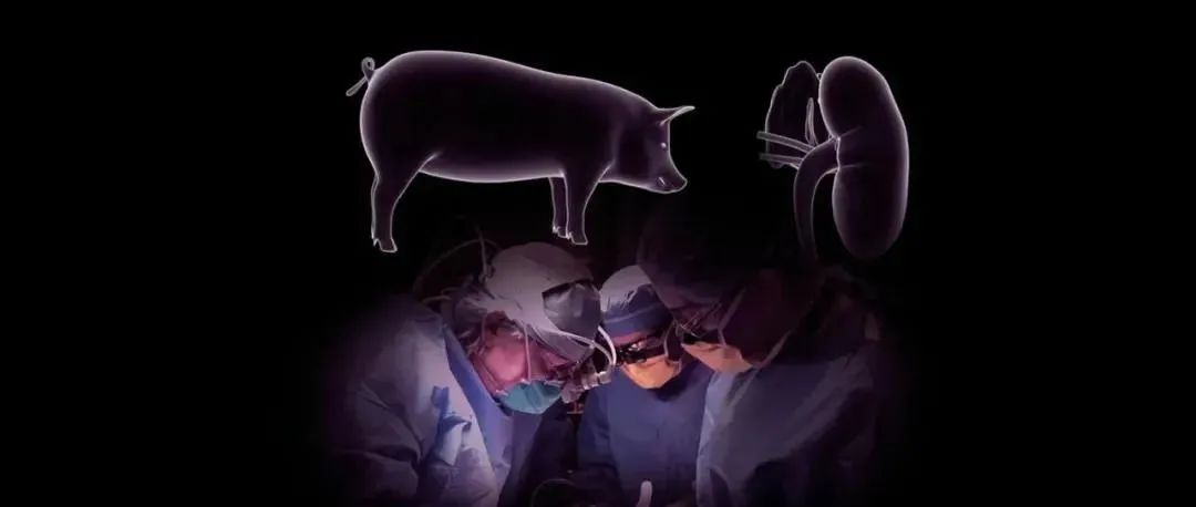 世界首例！猪肾成功移植人体，猪不仅好吃还能救命
