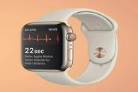 研究显示 Apple Watch可准确判断用户的身体“脆弱程度”