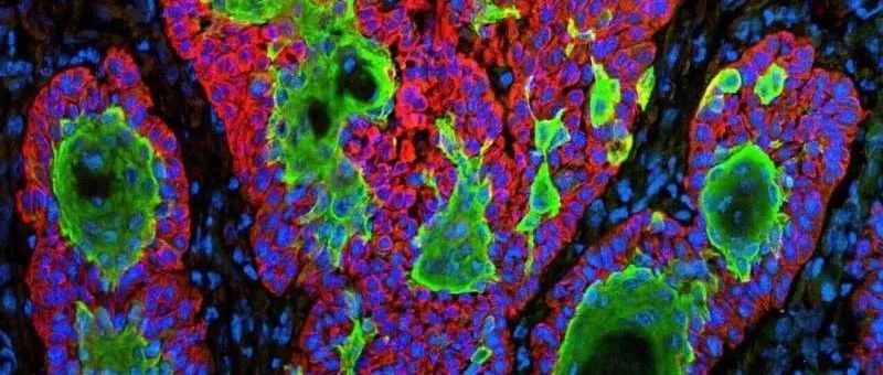 连发Cell，Nature顶级期刊，揭示脊髓和脑干在触摸中令人惊讶的新作用