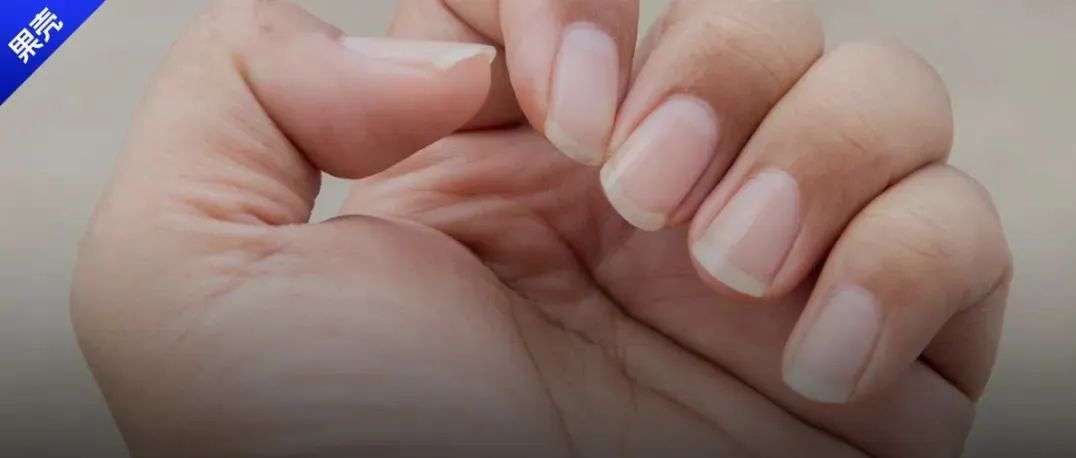 指甲上的“月牙”，真的是健康的血条吗？