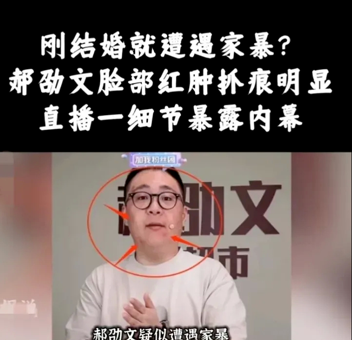 刚结婚就被家暴？郝邵文直播脸部有大量抓痕，妻子婚史再被扒出