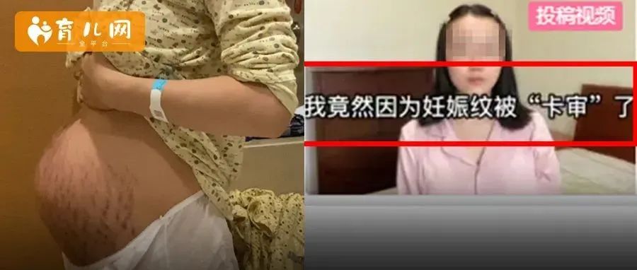 宝妈分享生产日记惨遭平台卡审，竟是因为“妊娠纹”这三个字...