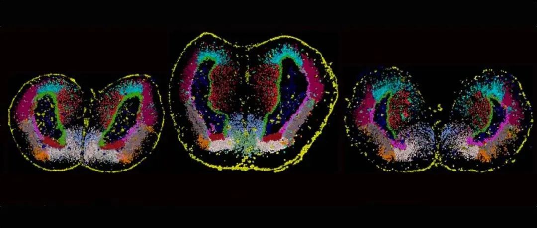 Science重磅封面：中国团队发布全球首个脑再生图谱！