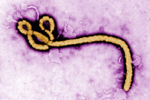 埃博拉“15分钟速测”已通过世卫组织批准