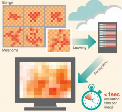IBM在医学影像领域发力，一张照片就能诊断皮肤癌